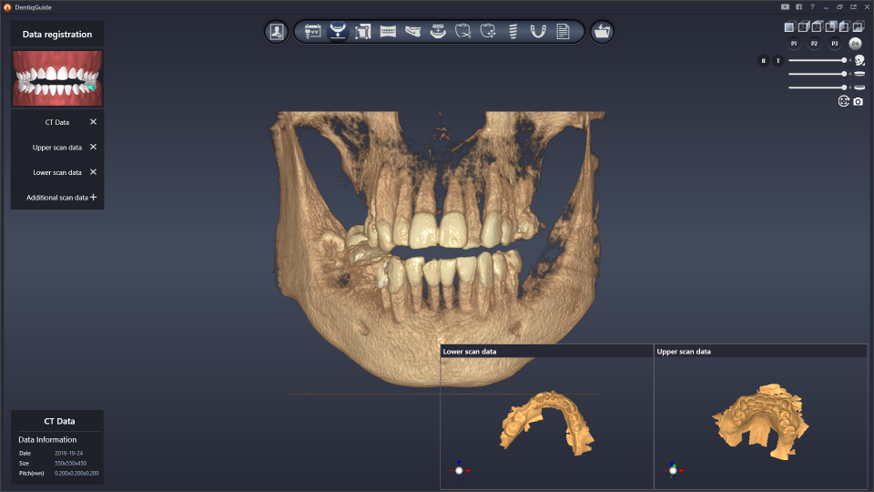 DentiqGuide Software Interface